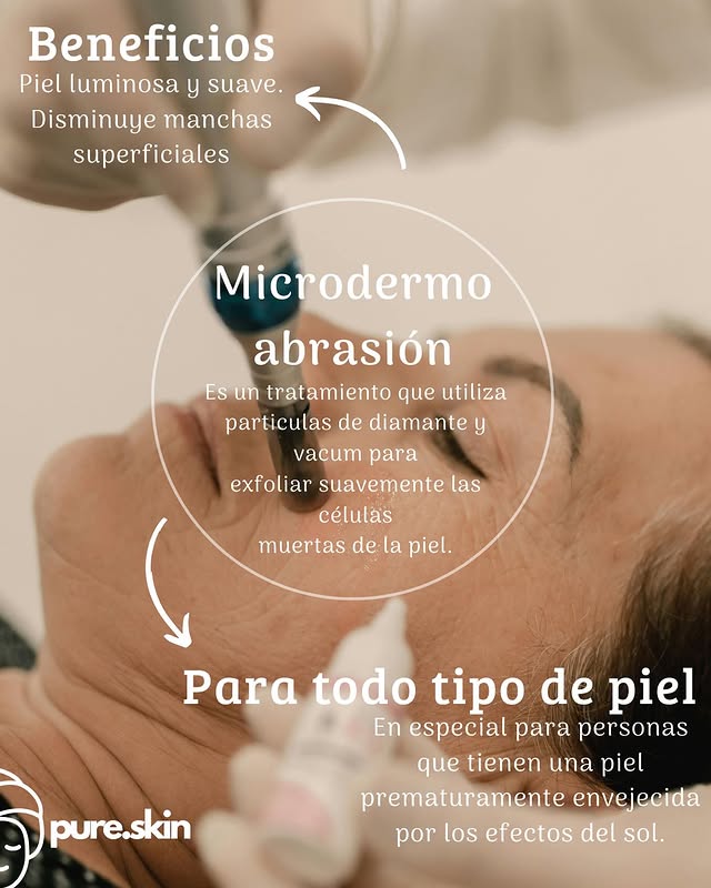 Microdermoabrasión